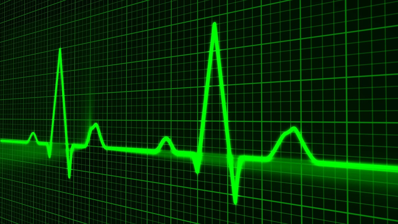 pulse-trace-163708_1280